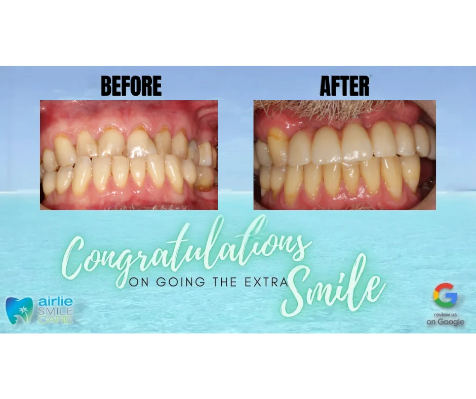 Airlie Smile Care smile showcase